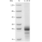 Recombinant Mouse IL-10 Protein (His-tag)