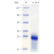 Recombinant Rat IL-10 Protein (His-tag)