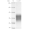 Recombinant Human IL-13 Protein (His-tag)