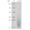 Recombinant Mouse IL-13 Protein (His-tag)