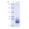 Recombinant Mouse IL-16 Protein (His-tag)