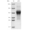 Recombinant Human LIF Protein (His-tag)