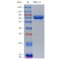 Recombinant Human TRFE Protein (His-tag)
