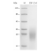Recombinant Mouse CSF2 Protein (His-tag)