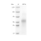 Recombinant Mouse PGF Protein (His-tag)