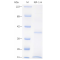 Recombinant Human IGF1 Protein (His-tag)