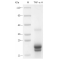 Recombinant Human TNF-alpha Protein (His-tag)
