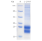 Recombinant Mouse IL-17A Protein (His-tag)