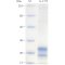 Recombinant Rat IL-17A Protein (His-tag)