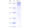 Recombinant Mouse EGF Protein (His-tag)