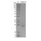 Recombinant Human FNDC5 Protein (His-tag)