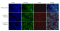 Recombinant Human FNDC5 Protein (His-tag)