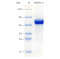 Recombinant Human PDGFD Protein (His-tag)
