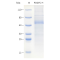 Recombinant Human PDGFC Protein (His-tag)