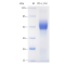 Recombinant Mouse PDL1 Protein (His-tag)