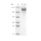 Recombinant Human CD31 Protein (His-tag)