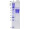 Recombinant Human CD86 Protein (His-tag)