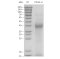 Recombinant Human CD1A Protein (His-tag)