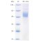 Recombinant Human CD19 Protein (His-tag)