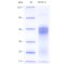 Recombinant Human CD74 Protein (His-tag)