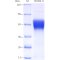 Recombinant Human CD354 Protein (His-tag)