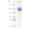 Recombinant Mouse CD365 Protein (His-tag)