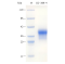 Recombinant Human CD369 Protein (His-tag)