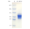 Recombinant Mouse CD369 Protein (His-tag)