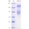 Recombinant Mouse CD80 Protein (His-tag)