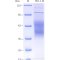 Recombinant Mouse TIM3 Protein (His-tag)