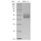 Recombinant Human SIRP alpha Protein (His-tag)