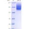 Recombinant Mouse SIRP alpha Protein (His-tag)