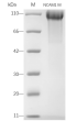 Recombinant Mouse NCAM1 Protein (His-tag)