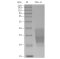 Recombinant Human FAS Protein (His-tag)