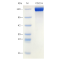 Recombinant Human CD22 Protein (His-tag)