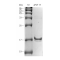 Recombinant Human aFGF Protein