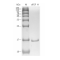 Recombinant Human aFGF Protein
