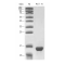 Recombinant Human PCT Protein