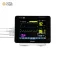 Biolight S10 Patient Monitor (1-Year Warranty)