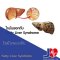 ไขมันพอกตับ(fatty liver disease)