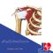 Rotator Cuff Tear 