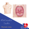 Pityriasis rosea  