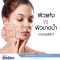 Recommend: How is dry skin vs dehydrated skin different?