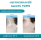 Acnevit Forte Blemish Antioxidant Serum 30ml (เซรั่ม AOXเพื่อคนผิวมัน เป็นสิวง่ายโดยเฉพาะ)