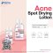 Acne Spot Drying Lotion