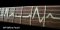 EKG / Heartbeat Line Inlay Sticker