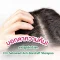 บอกลาความคัน! แชมพูขจัดรังแคจาก Sebamed Anti-Dandruff Shampoo