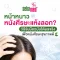 หน้าหนาวหนังศีรษะแห้งลอก? วิธีรับมือฉบับได้ผลจริง เพื่อหนังศีรษะสุขภาพดี