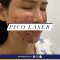 Pico Laser เลเซอร์ ฝ้า กระ ริ้วรอย