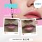 PINK LIPS  | เลเซอร์ปากชมพู